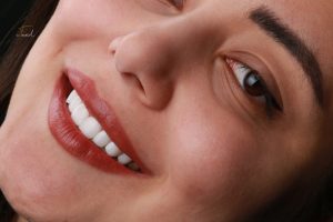 دندانپزشکی زیبایی مشهد